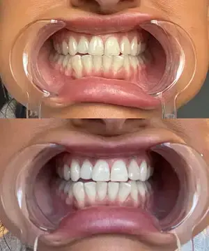 Whitening Mouthwash | Fresh Breath - Image 6