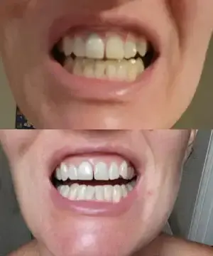 Whitening Mouthwash | Fresh Breath - Image 7