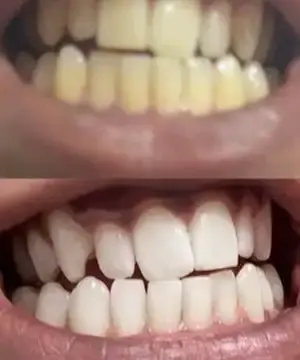 Whitening Mouthwash | Fresh Breath - Image 8