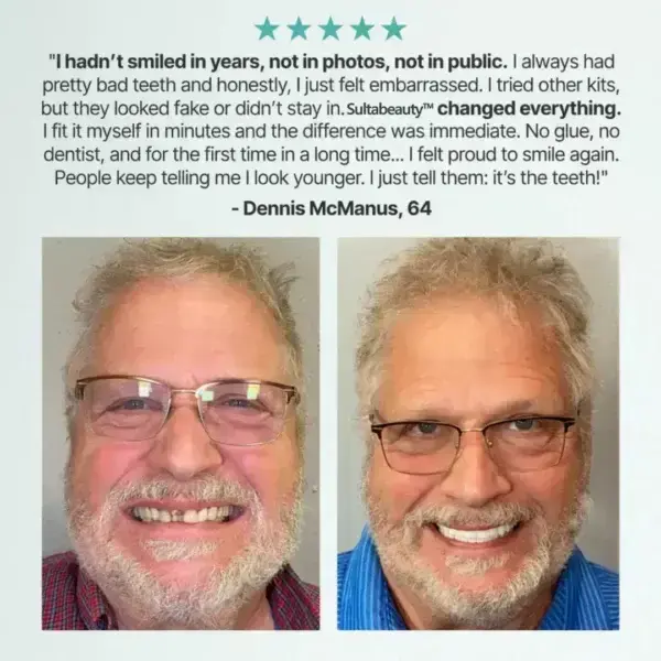 Full Denture - Image 2