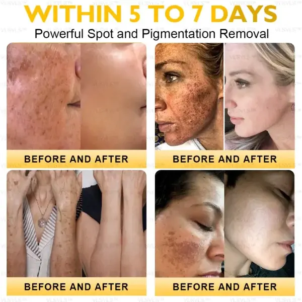 Ultimate All-Body Skin Restoration Cream - Image 5
