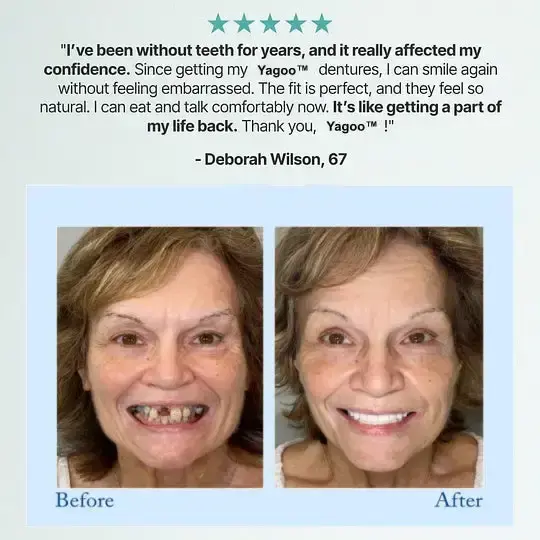 🦷Advanced Customized Full Denture Set🦷 (🔥10,000+ Sold In Last 30 Day) - Image 7
