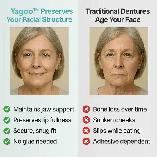 Custom Custom-Fit Full Functional Dentures - Image 8