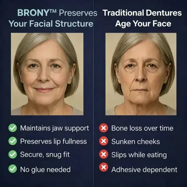 Second-Generation Complete Dentures: Professional 2026 Custom-Fit Smile - Image 4