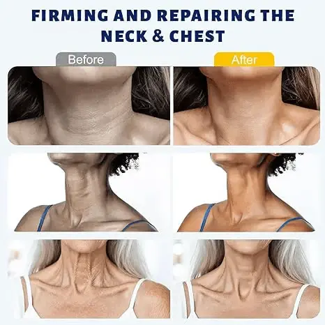 5-Ball Roller Neck Firming Cream with Retinol & Hyaluronic Acid - Image 4