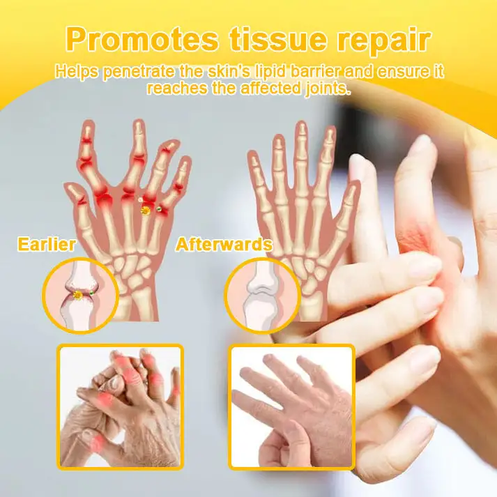 Botulinum & Bee Essence Pain-Relief Bone Healing Cream - Image 13
