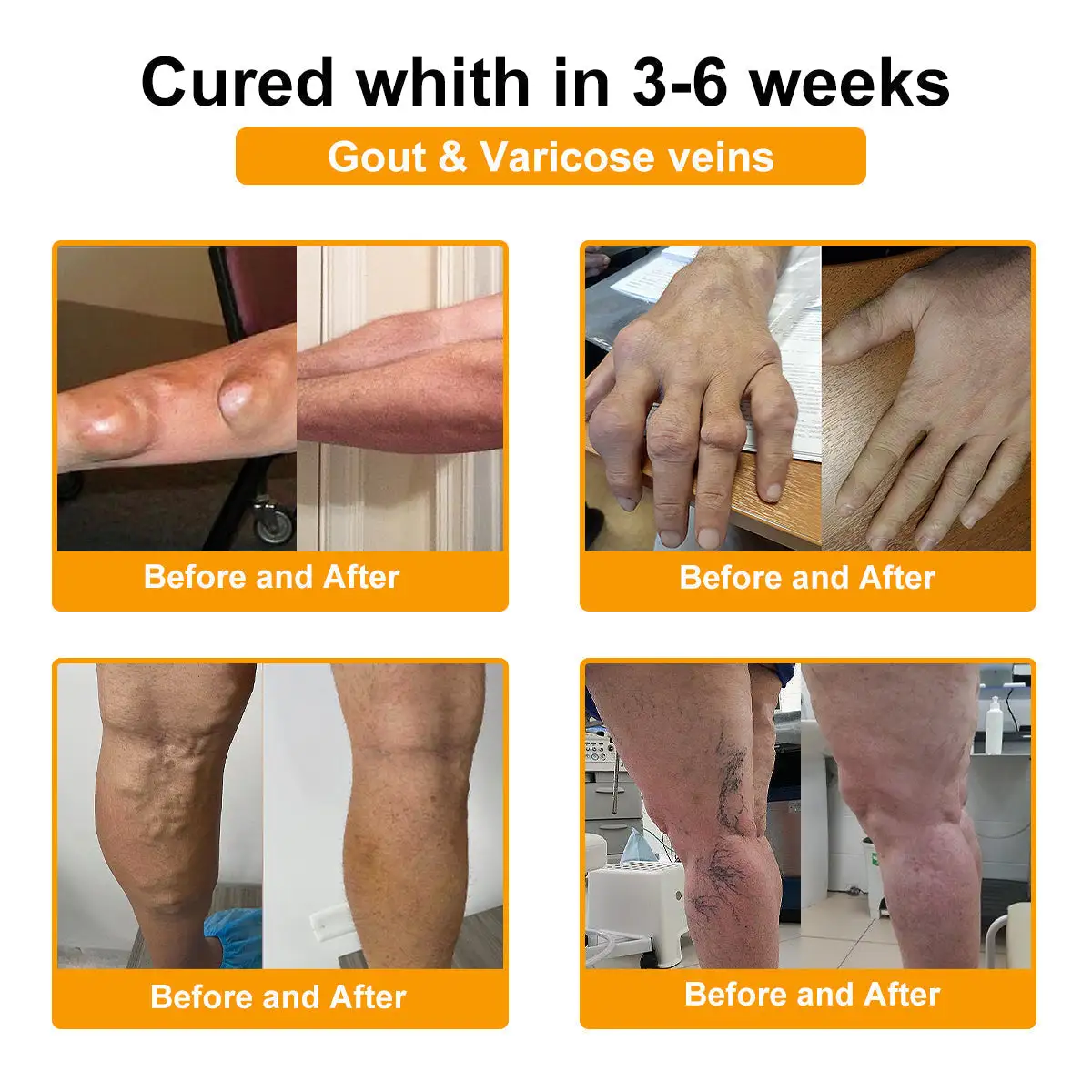 Botulinum & Bee Essence Pain-Relief Bone Healing Cream - Image 16
