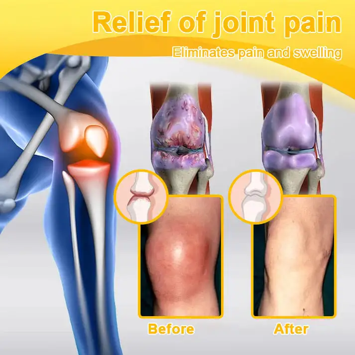 Botulinum & Bee Essence Pain-Relief Bone Healing Cream - Image 12
