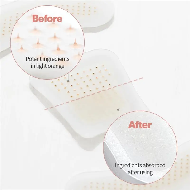 MicroSting Bee Vein Ease Patches - Image 9