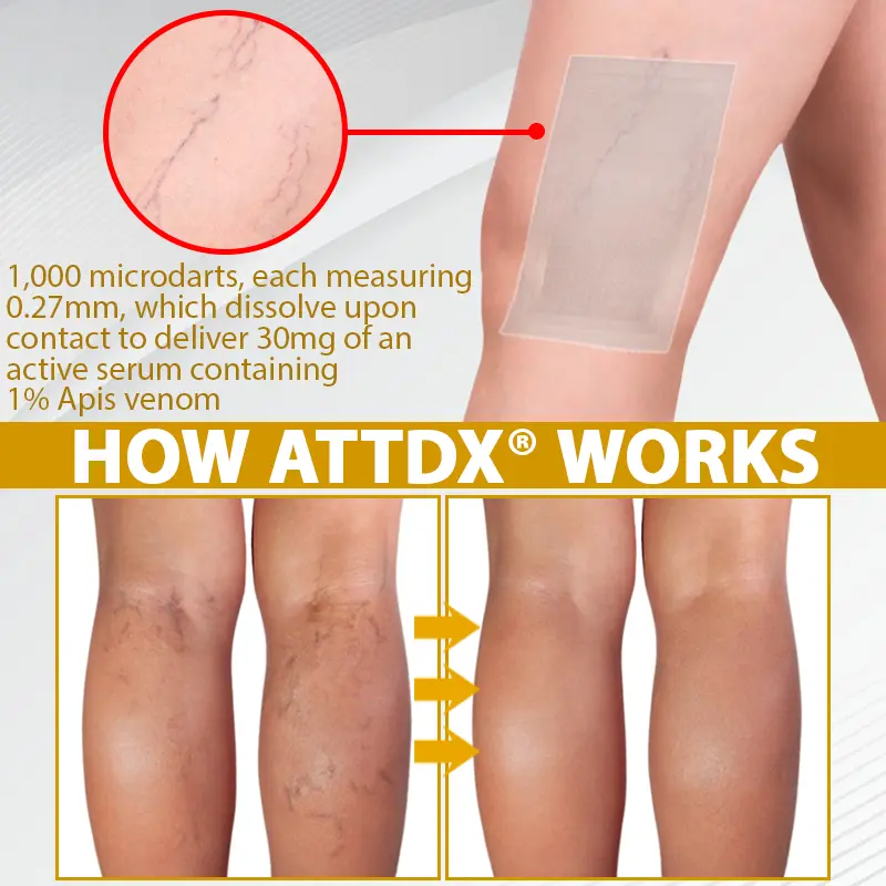 MicroSting Bee Vein Ease Patches - Image 10