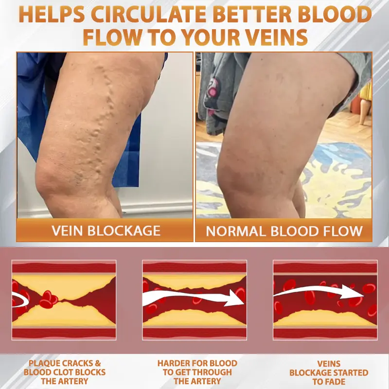 MicroSting Bee Vein Ease Patches - Image 12