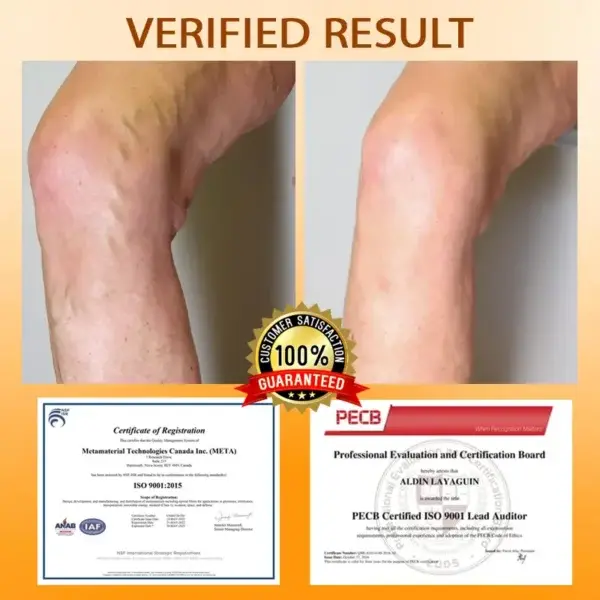 MicroSting Bee Vein Ease Patches - Image 7