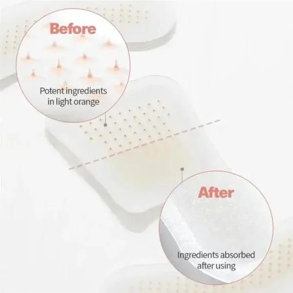 MicroSting Bee Vein Ease Patches - Image 8