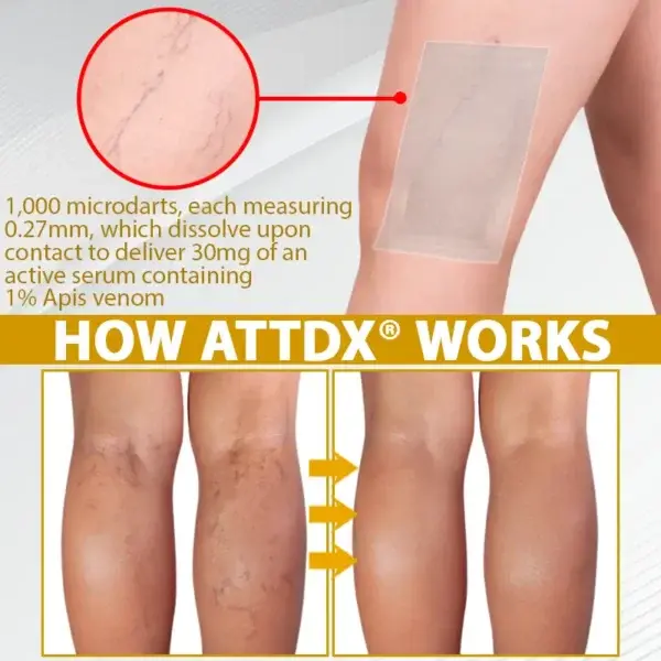 MicroSting Bee Vein Ease Patches - Image 9