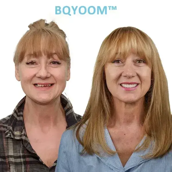 GelFit Dentures