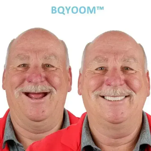 GelFit Dentures - Image 2