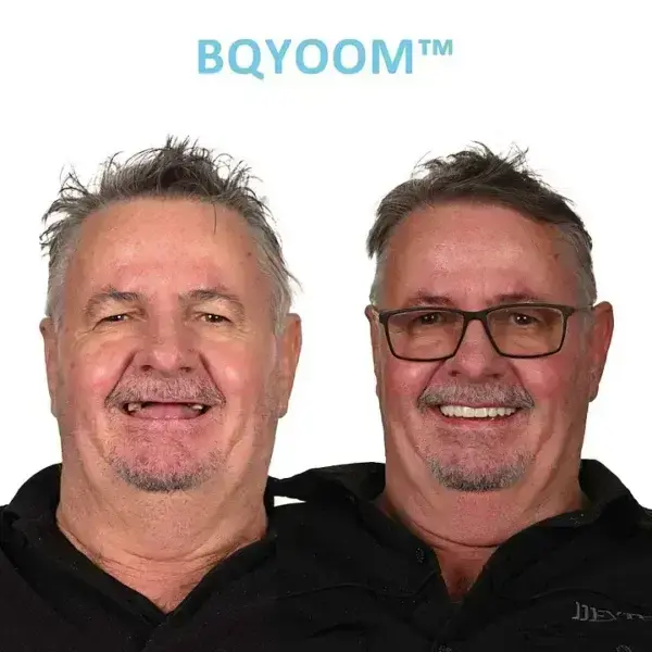 GelFit Dentures - Image 3