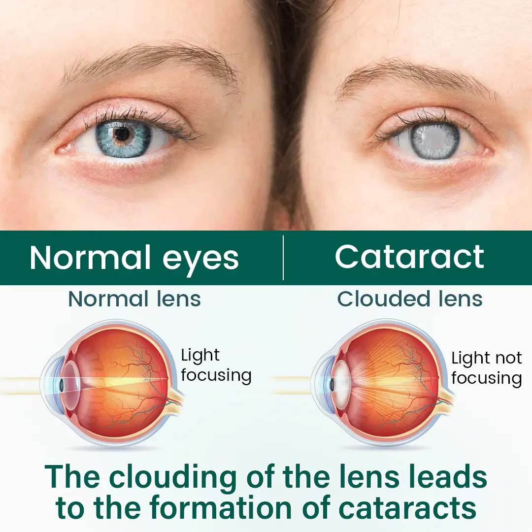 BalanceVie OptiClear Nano Eye Roller Serum - Image 4
