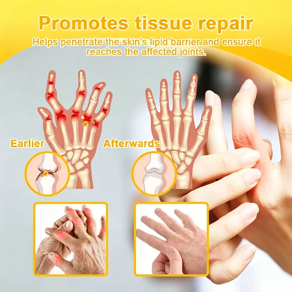 Bellevery Joint & Bone Recovery Patch | Targeted Joint Comfort - Image 3