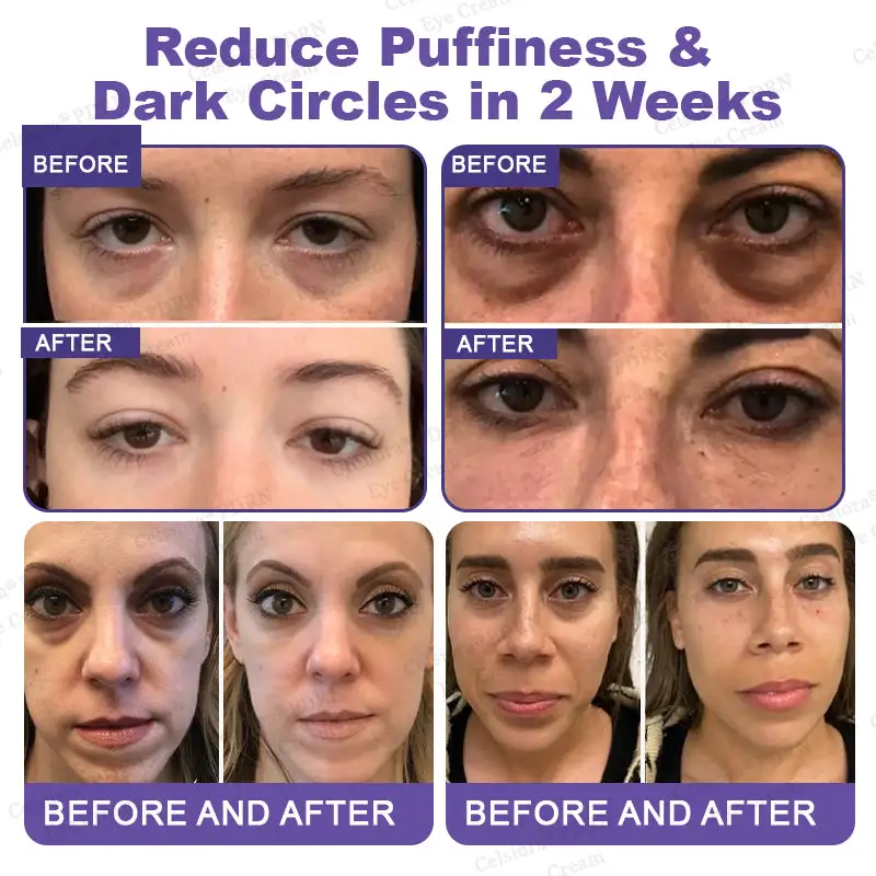 PDRN Renewal Complex Eye Cream - Image 3