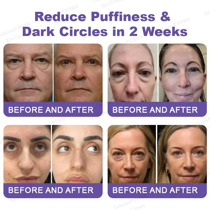 PDRN Renewal Complex Eye Cream - Image 4