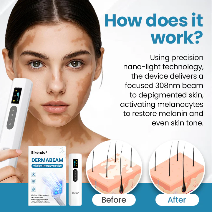 Vitiligo Therapy Device - Image 4