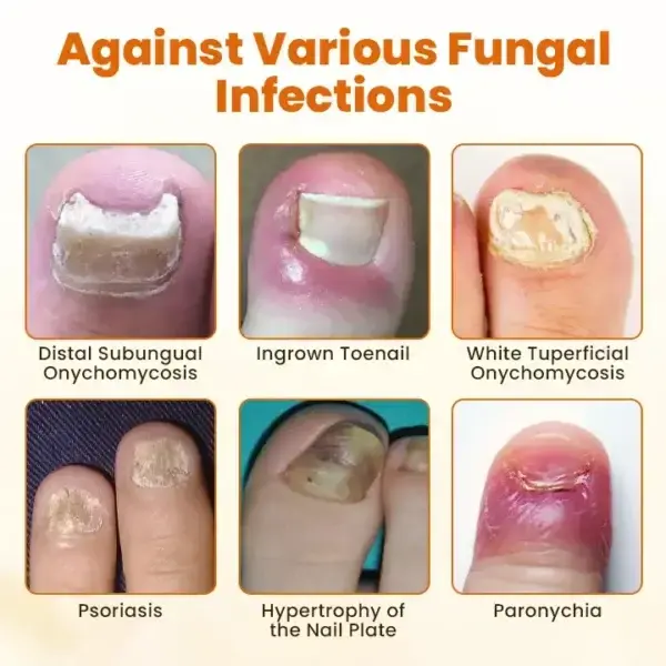 FungiFix Bee Venom Nail Spray - Image 7