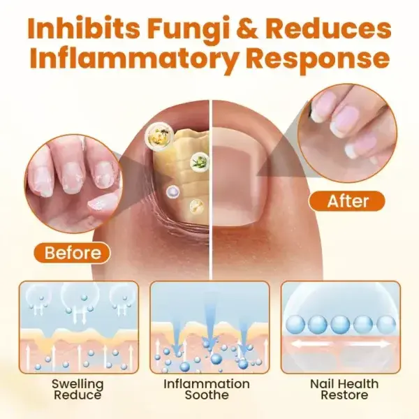 FungiFix Bee Venom Nail Spray - Image 8