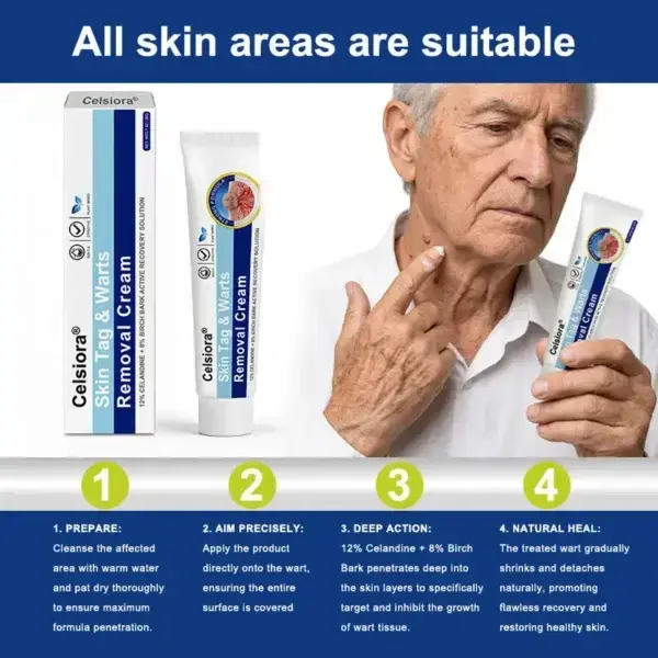 Skin Tag & Wart Removal Cream - Painless At-Home Treatment
