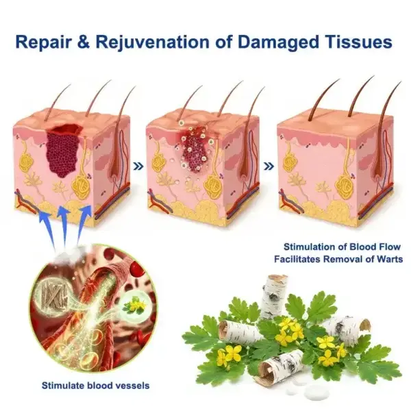 Skin Tag & Wart Removal Cream - Painless At-Home Treatment - Image 4