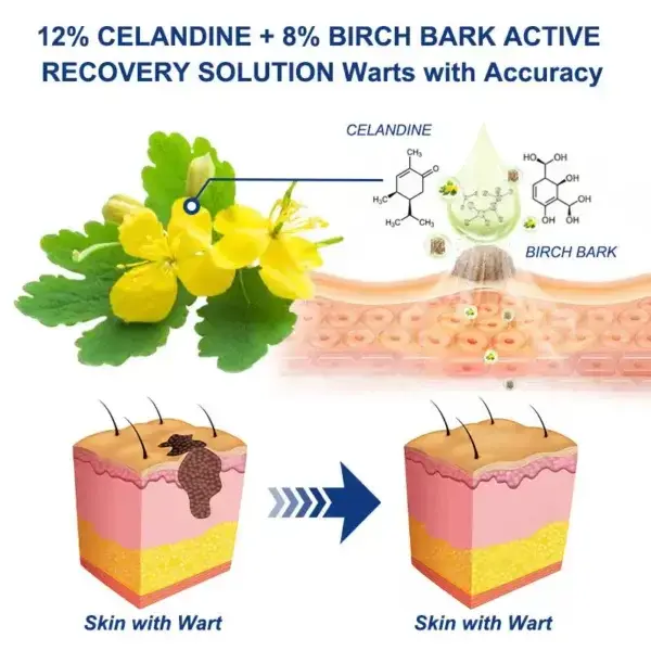 Skin Tag & Wart Removal Cream - Painless At-Home Treatment - Image 5