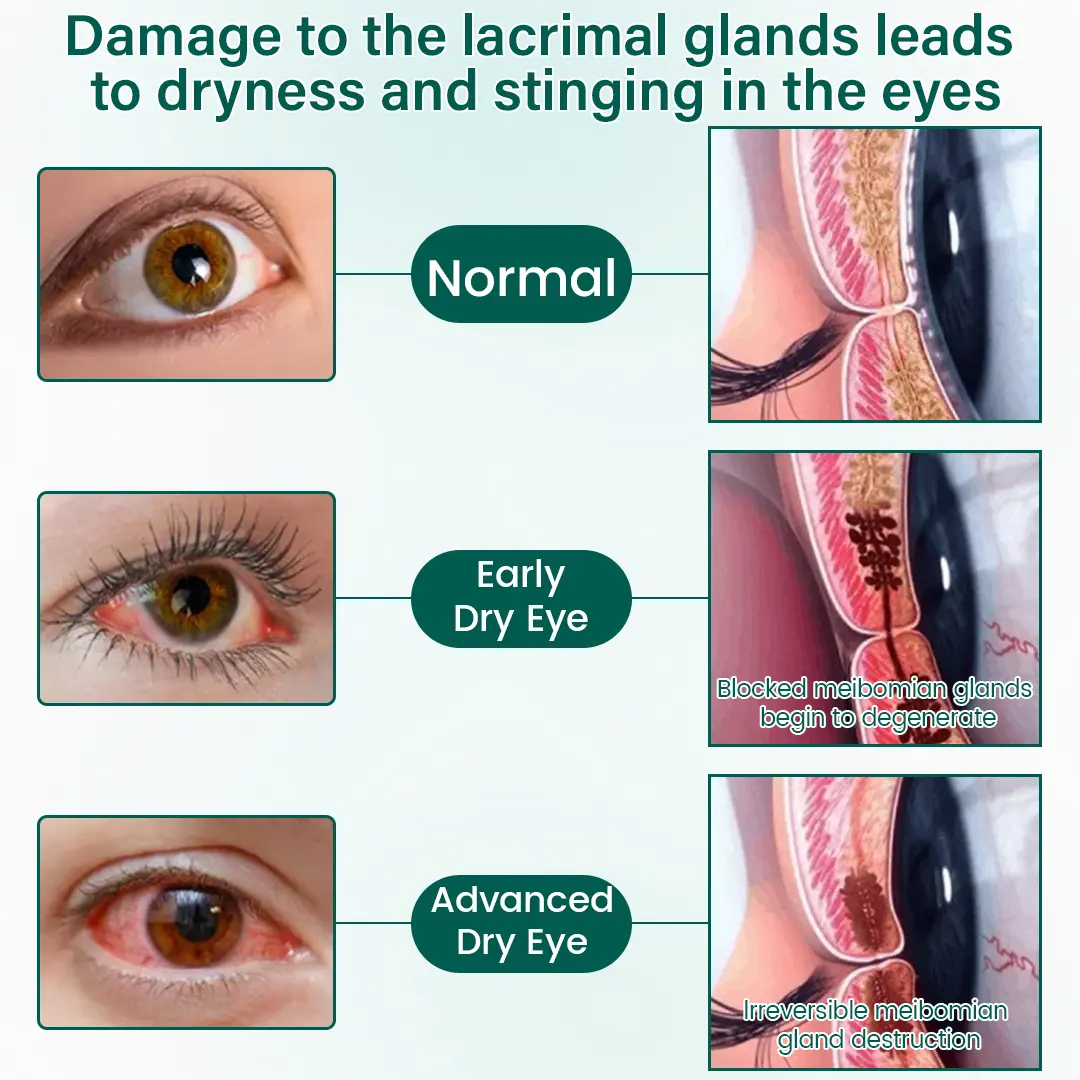 OptiClear Nano Eye Roller Serum - Image 7