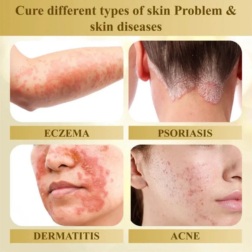 Condense Mellifera Venom Skin Repairing Cream - Image 10