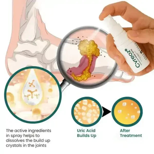 Cvreoz GoutEase Relief Spray | Fast-Acting Gout Pain Relief - Image 5