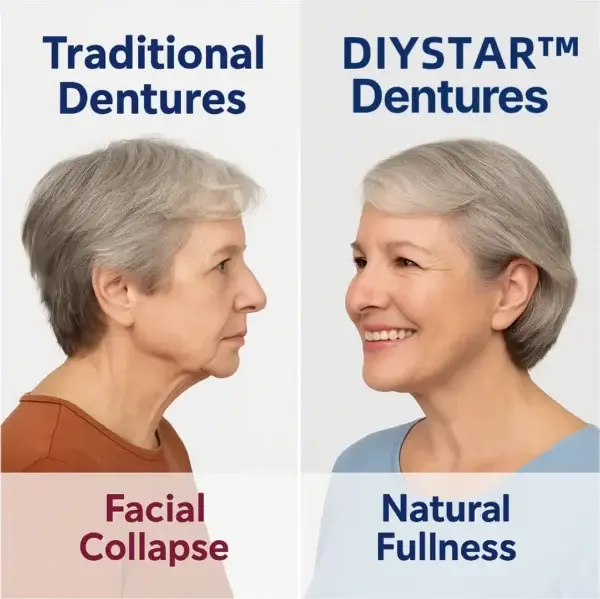 Custom-Fit Functional Dentures - Image 9