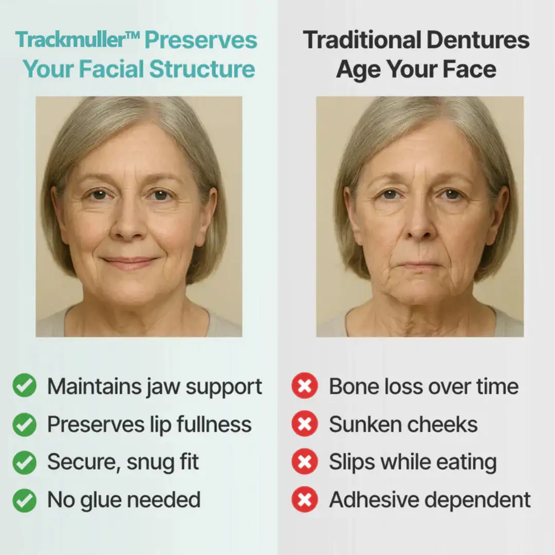 🌎Ends Today: 70% OFF! Full Denture with Strong Suctiond - Image 10