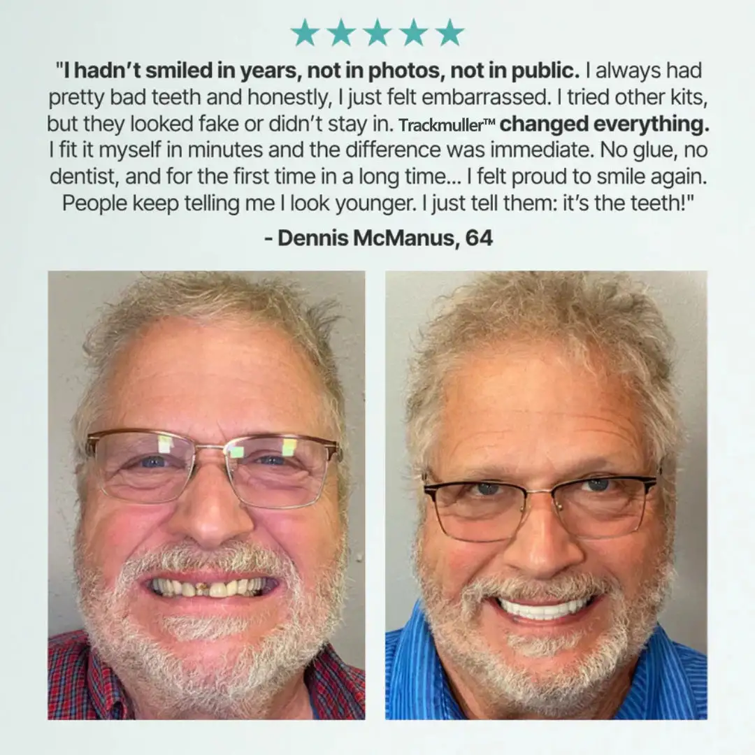 🌎Ends Today: 70% OFF! Full Denture with Strong Suctiond - Image 13