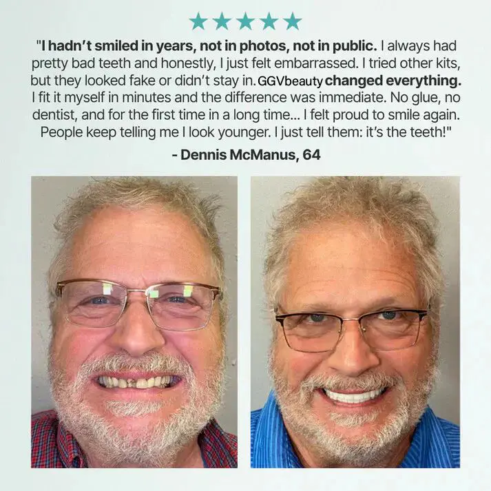 GGVbeauty Custom-Fit Dentures | At-Home Functional Teeth - Image 6
