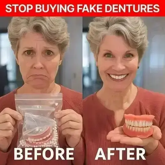 🎁🦷 CustomFit Smile Support Set ⏰ ENDS TODAY 49% OFF | Smile with Confidence😉 - Image 7