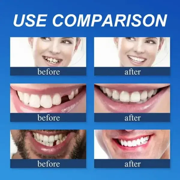Custom-Fit Dentures - Image 11