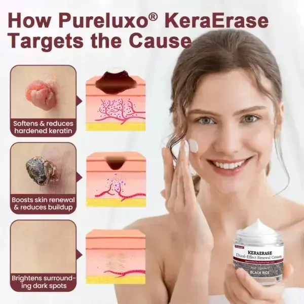 KeraErase DualEffect Renewal Cream - Image 6