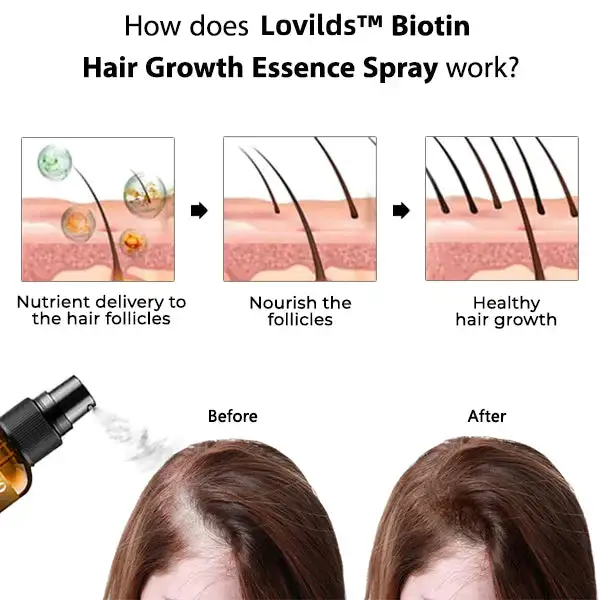 (🔥LAST DAY SALE-80% OFF) Biotin Premium Hair Growth Serum - Image 4