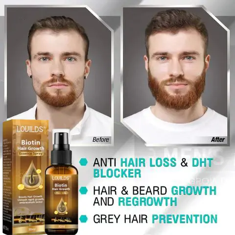 (🔥LAST DAY SALE-80% OFF) Biotin Premium Hair Growth Serum - Image 6