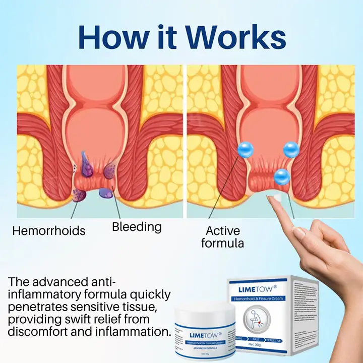 Hemorrhoid & Fissure Relief Cream - Image 4