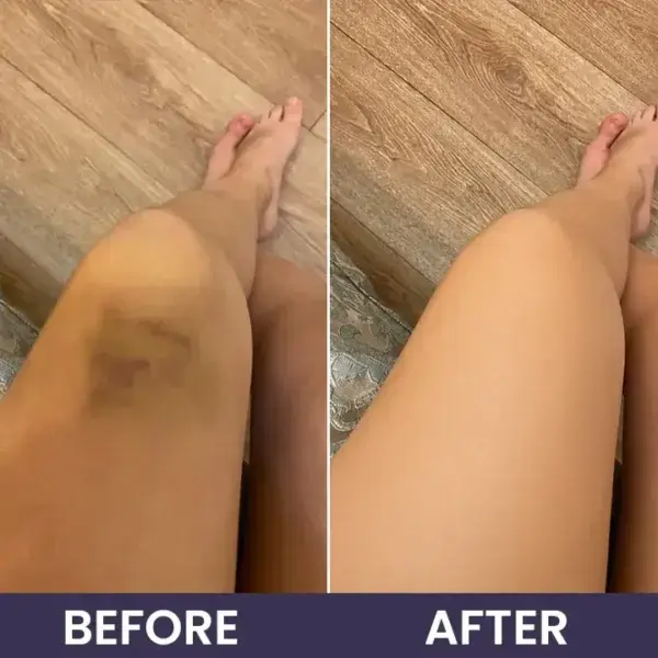 Bruise Repair & Skin-Strengthening Cream - Image 14