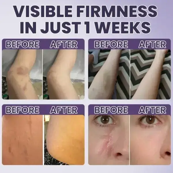 Bruise Repair & SkinStrengthening Cream - Image 11