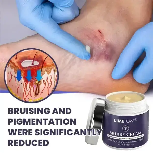 Bruise Repair & SkinStrengthening Cream - Image 7