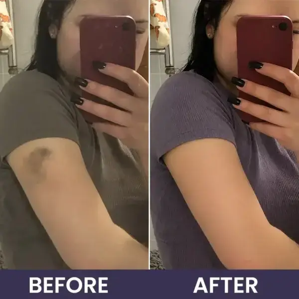 Bruise Repair & Skin-Strengthening Cream - Image 13
