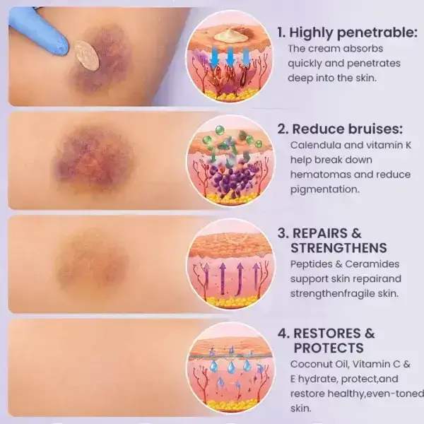 Bruise Repair & Skin-Strengthening Cream - Image 12
