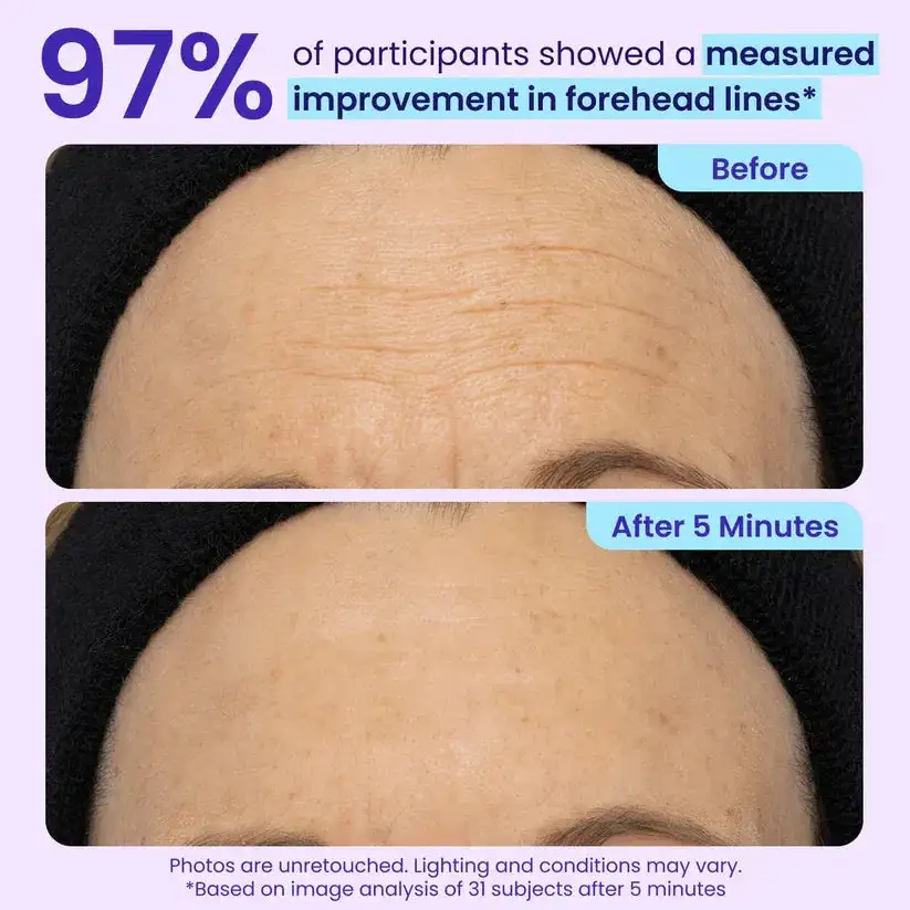 Maiakoo Instant Lift Eye Gel for Puffiness, Bags & Wrinkles - Image 10